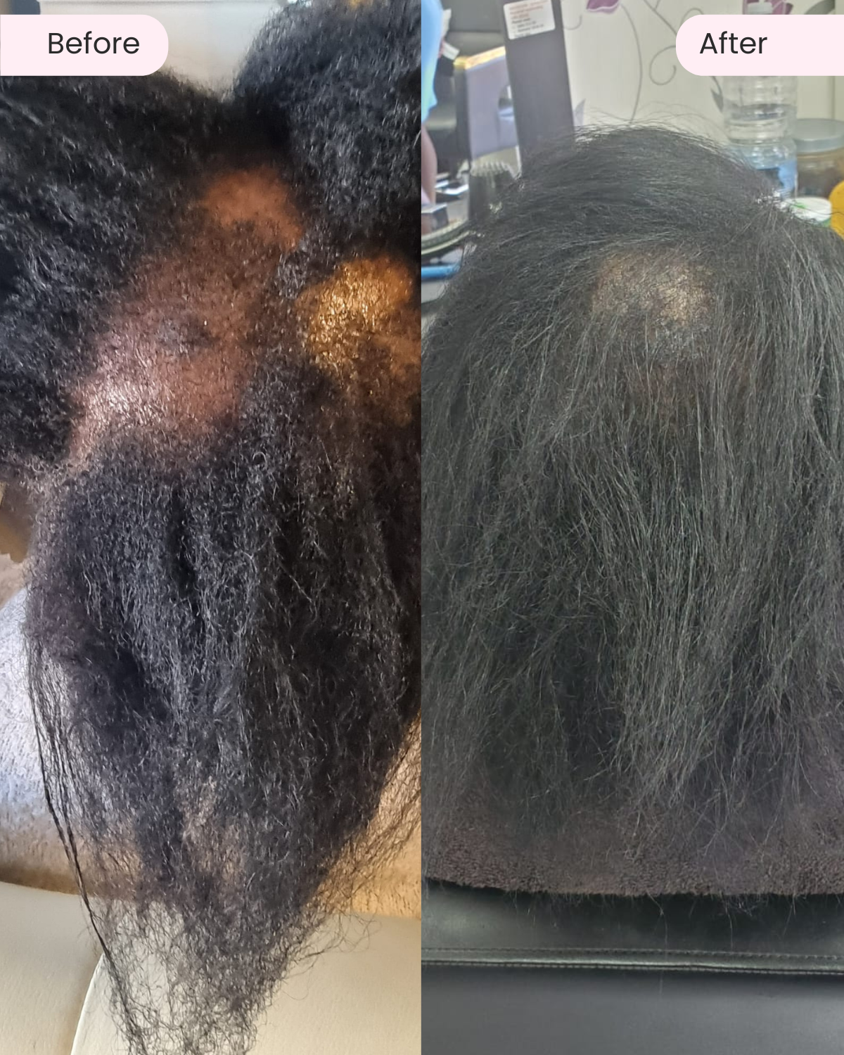 Stimulating Scalp Cream 150ML