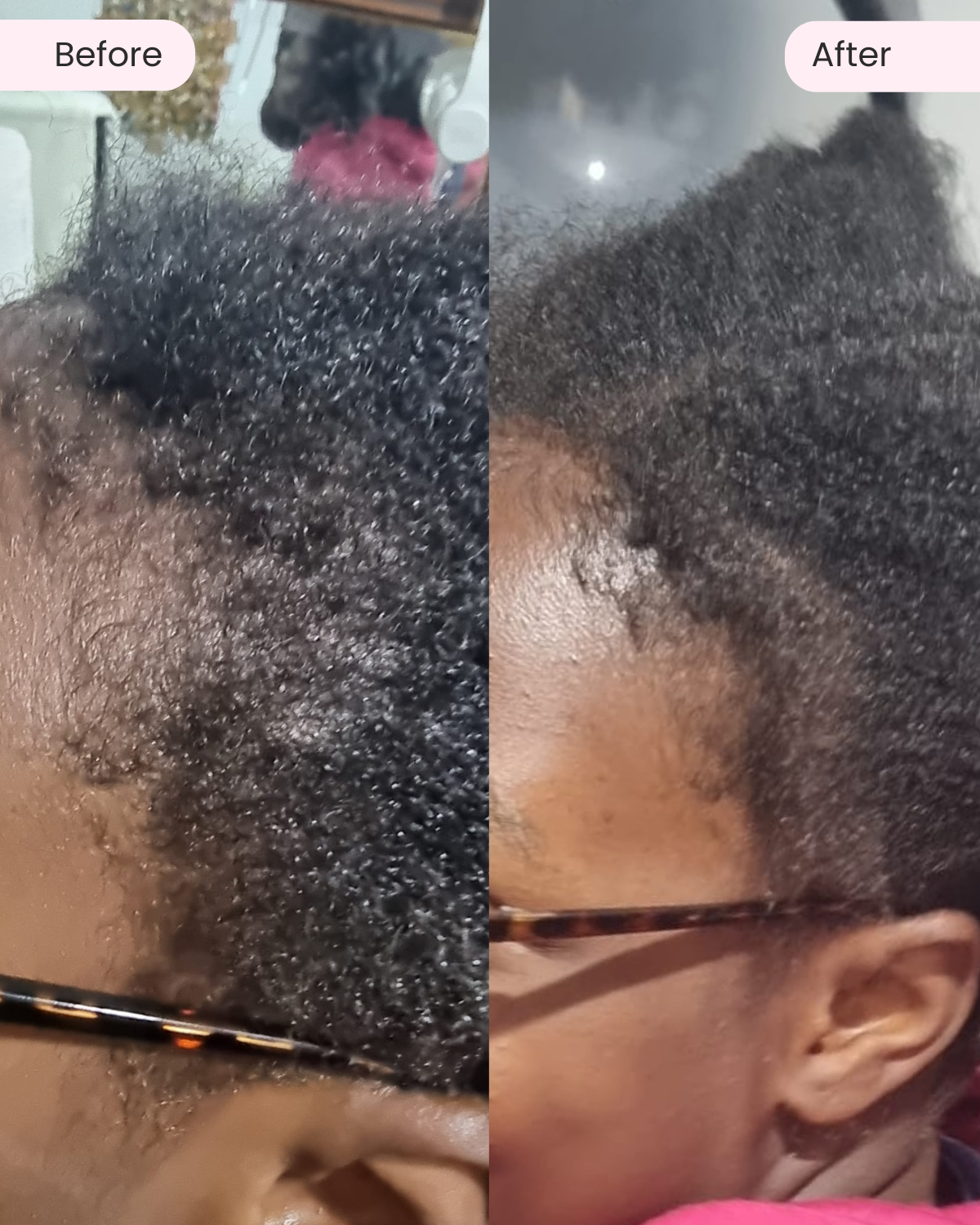 Stimulating Scalp Cream 150ML